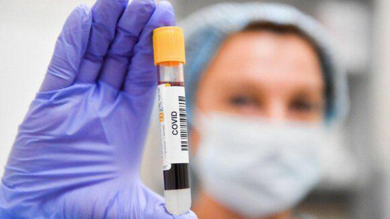 Более половины российских врачей относятся настороженно к отечественной вакцине от коронавируса