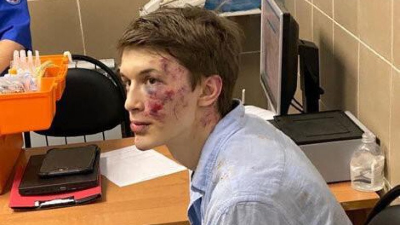 В Москве избит блогер и ведущий «Эха Москвы» Егор Жуков